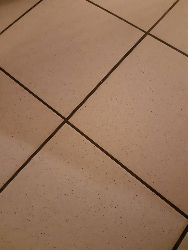 Réaliser un lifting colombien pour paraître plus jeune à Villenave-d'Ornon