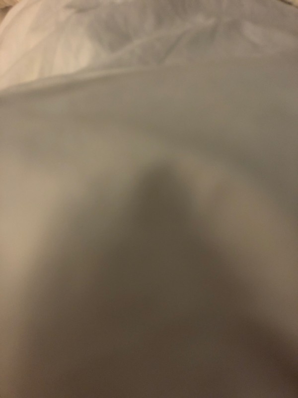 Recherche salon de Laser pas cher spécialisé dans l’effacement des Vergetures après grossesse à Bordeaux