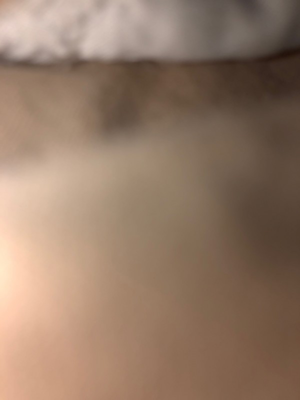 Recherche podologue spécialisé dans le traitement des verrues et ongles incarnés à Bordeaux